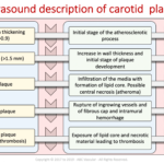 Carotid Course Info | Abc Vascular In Carotid Ultrasound Report Template